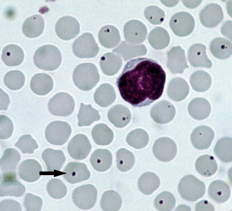 Anaplasma bacteria in white blood cells