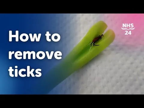 Video preview: how to remove a tick safely